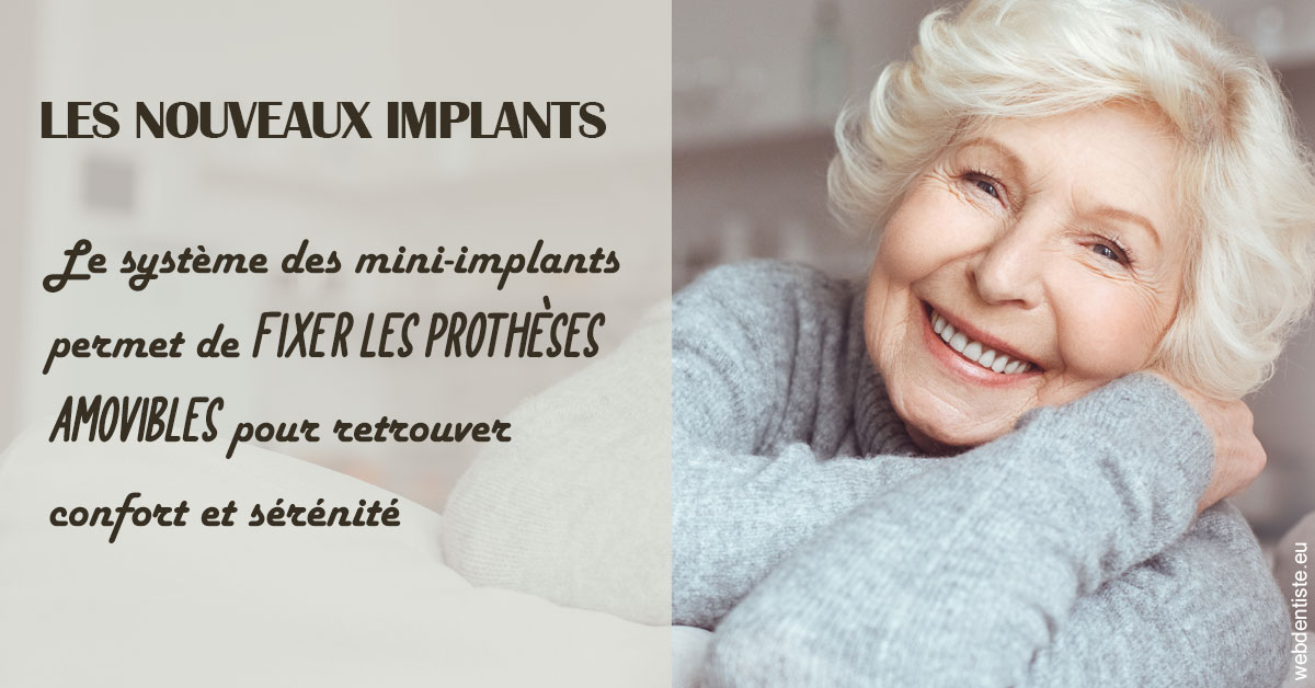 https://dr-yves-gozlan.chirurgiens-dentistes.fr/Les nouveaux implants 1