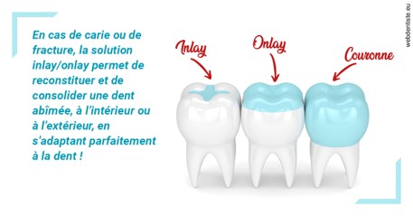 https://dr-yves-gozlan.chirurgiens-dentistes.fr/L'INLAY ou l'ONLAY