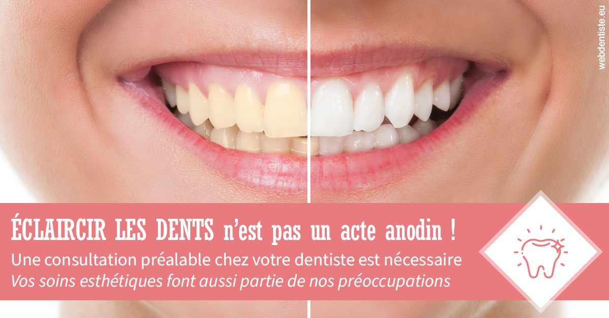 https://dr-yves-gozlan.chirurgiens-dentistes.fr/Eclaircir les dents 1