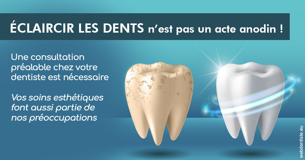 https://dr-yves-gozlan.chirurgiens-dentistes.fr/Eclaircir les dents 2