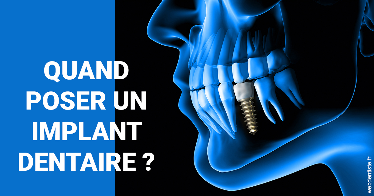 https://dr-yves-gozlan.chirurgiens-dentistes.fr/Les implants 1