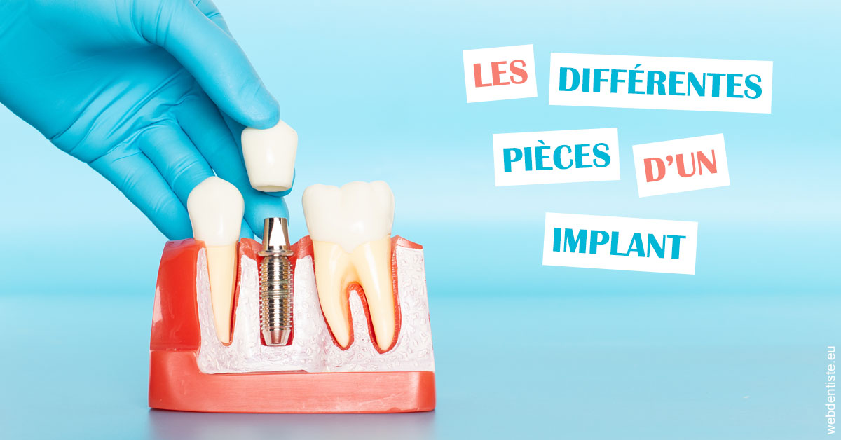 https://dr-yves-gozlan.chirurgiens-dentistes.fr/Les différentes pièces d’un implant 2