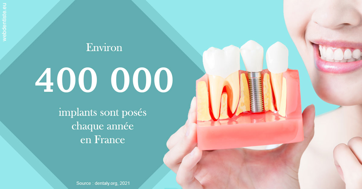 https://dr-yves-gozlan.chirurgiens-dentistes.fr/Pose d'implants en France 2