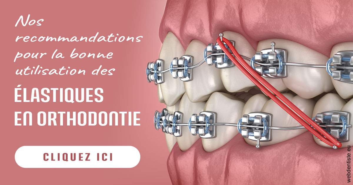 https://dr-yves-gozlan.chirurgiens-dentistes.fr/Elastiques orthodontie 2